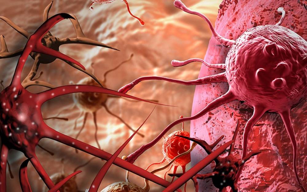 KIẾN GIẢI VỀ CHỮA TRỊ UNG THƯ - PHẦN 2: UNG THƯ LÀ ĐỘC TỐ NẰM Ở MỘT VỊ TRÍ NÀO ĐÓ TRONG CƠ THỂ TỤ LẠI CHỜ BỊ ĐẨY RA NGOÀI