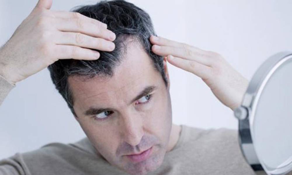 RỤNG TÓC Ở NAM GIỚI VÀ CÁC THÔNG TIN CẦN BIẾT